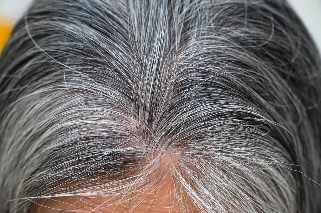 greying of hair